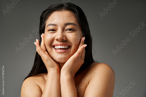 carefree and young asian woman with brunette hair and acne prone skin smiling on grey background