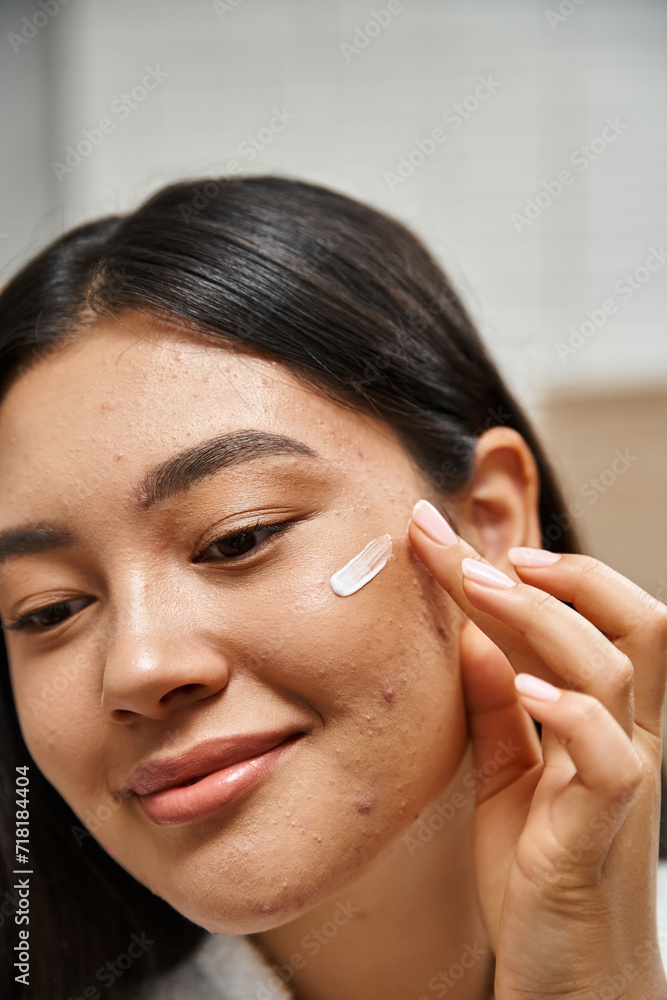 close up photo of young asian woman with brunette hair applying acne treatment cream on face close up photo of young asian woman with brunette hair applying acne treatment cream on face