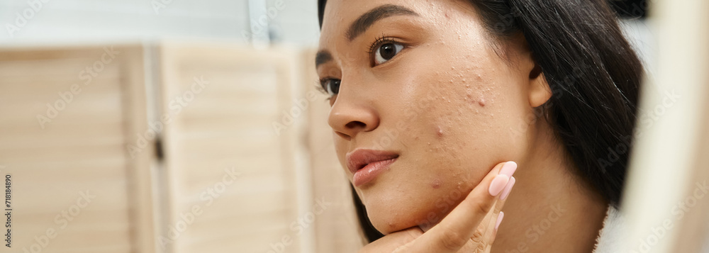 Εκτύπωση καμβά young asian woman with brunette hair and acne prone skin looking at mirror in ba