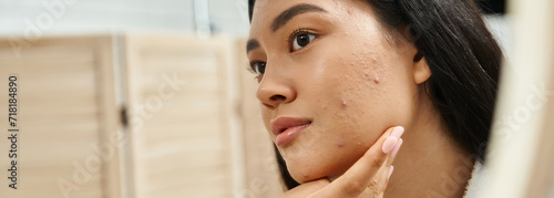 Εκτύπωση καμβά young asian woman with brunette hair and acne prone skin looking at mirror in ba