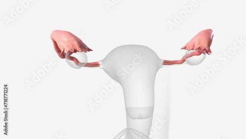 The fallopian tubes are bilateral conduits between the ovaries and the uterus in the female pelvis . photo