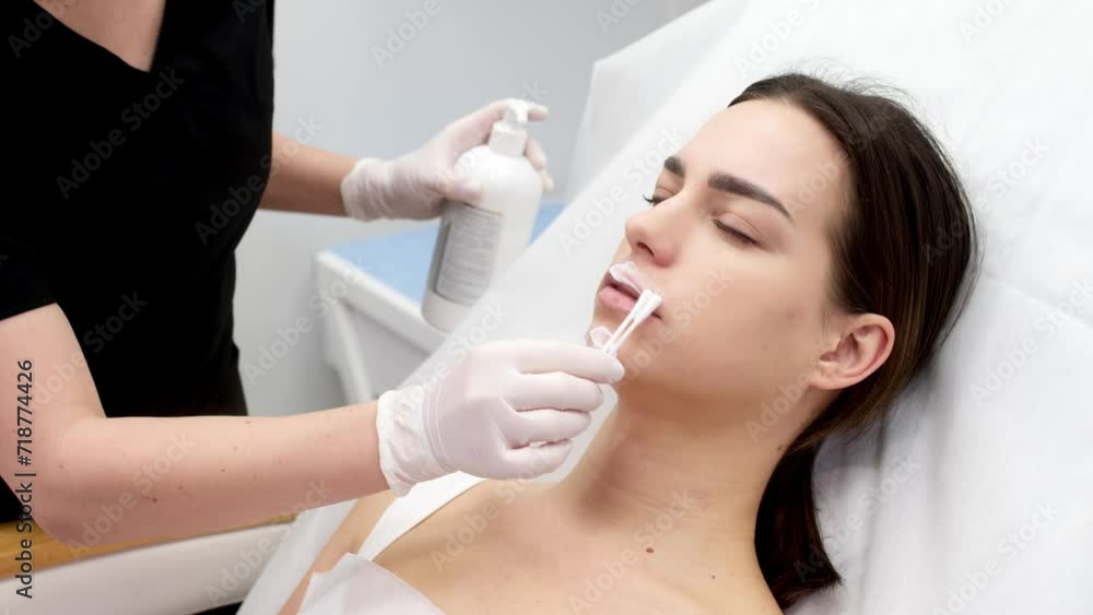 Cosmetology clinic, the doctor applies anesthesia to the patient's lips, anesthetic before injecting hyaluronic acid. Anesthetic ointment is applied before the injection procedure. Cosmetology clinic, the doctor applies anesthesia to the patient's lips, anesthetic before injecting hyaluronic acid. Anesthetic ointment is applied before the injection procedure.