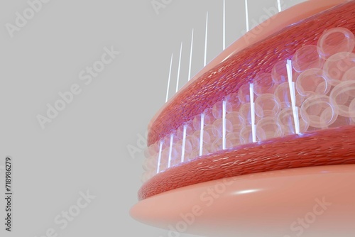 HIFU laser treatment shot laser deep to SMAS to enhancing the radiance, firmness and suppleness of skin. 3D rendering.