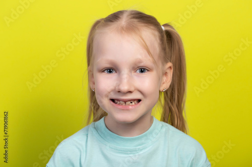 Portrait of a smiling seven-year-old girl with growing molars and falling out baby teeth. Defects of crooked teeth in the oral cavity. Children's dentistry, orthodontic