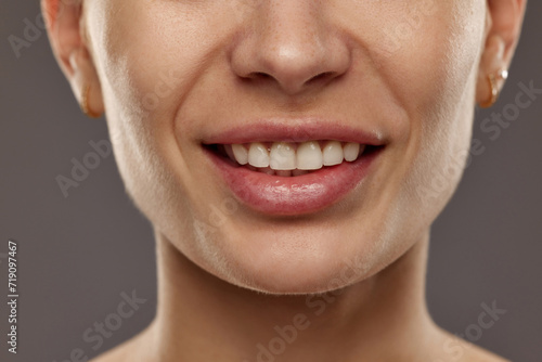 Cropped image of female face against studio background. Young woman smiling. Teeth whitening  dental care. Concept of natural beauty  cosmetology and cosmetics  skin care  dental treatment