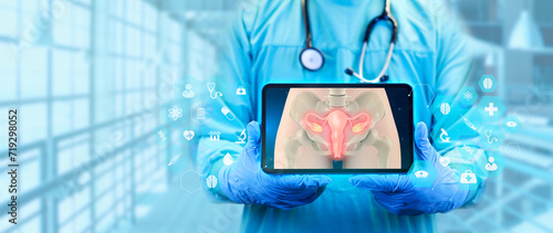 image of uterus on doctor's tablet. Cervical cancer, uterine fibroids, hysterectomy. Female reproductive health concept. Control and care of the female reproductive system photo