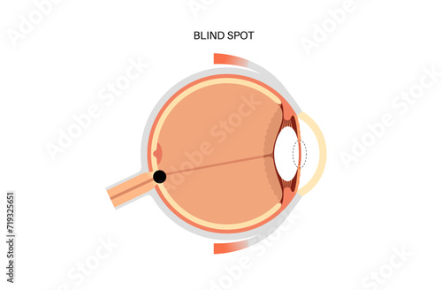 Blind spot poster