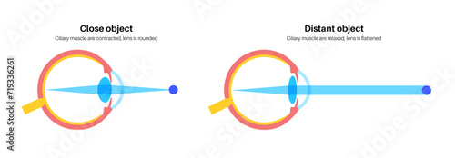 Eye accommodation poster