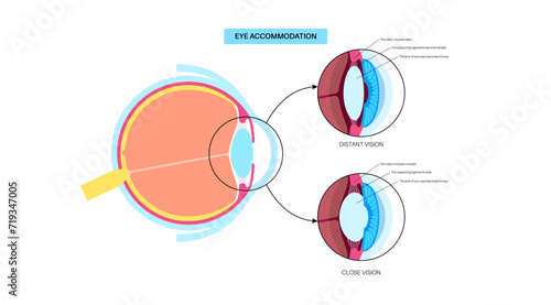 Eye accommodation poster