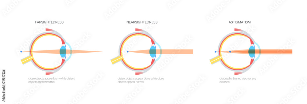 Farsightedness and nearsightedness - obrazy, fototapety, plakaty 