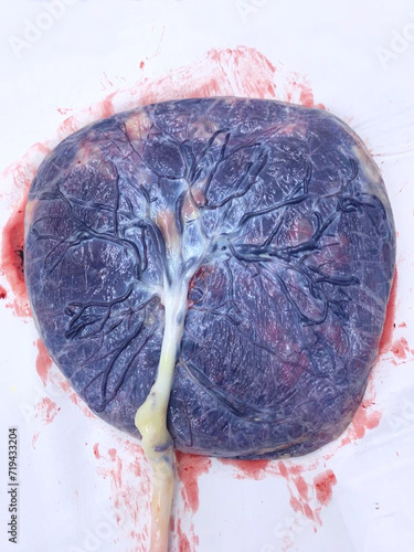 A placenta with umbilical cord on a white table after birth