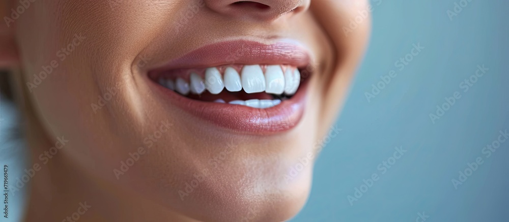 Fototapeta premium Perfect healthy teeth smile of a young woman Teeth whitening Dental clinic patient Image symbolizes oral care dentistry stomatology. Copy space image. Place for adding text