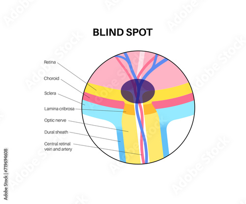 Blind spot poster