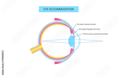 Eye accommodation poster