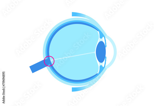 Blind spot poster