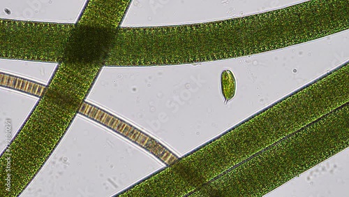 Euglena phacus trapped between a forest of filamenous cyanobacteria. Phacus swims with a beautiful corkscrew motion. Shot in real time under the microscope at 200x magnification. photo