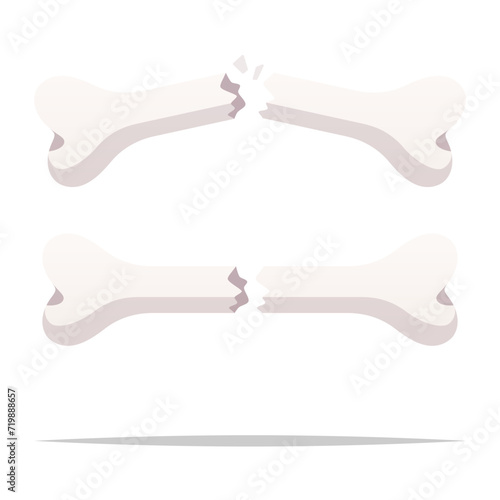 Broken bone fracture vector isolated illustration