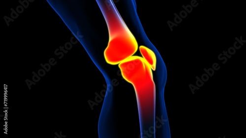 Knee joint pain anatomy for medical concept 3D rendering