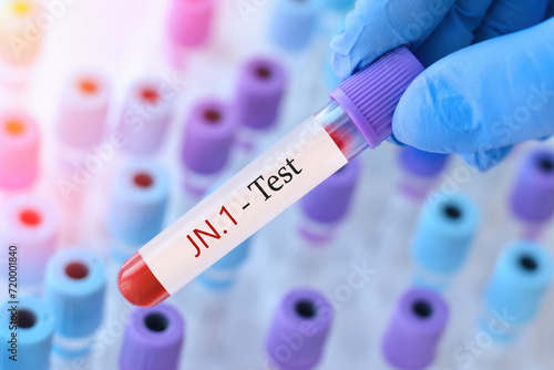 Doctor holding a test blood sample tube with positive SARS-CoV-2 Variant JN.1 virus test on the background of medical test tubes with analyzes. photo