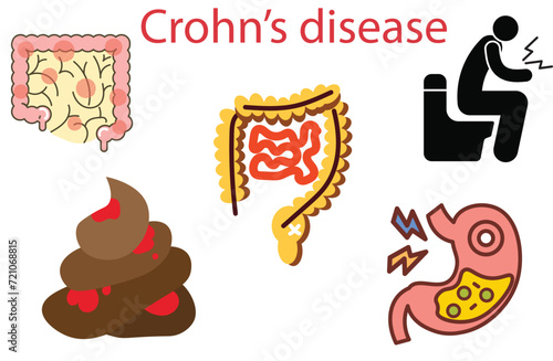 crohn’s disease,Crohn's disease black  icon,Stomach Disease,bloo poop,.Autoimmune diseases.blood  poop, stomachache campylobacter infection. Bacteria in intestine in flat design,five photo