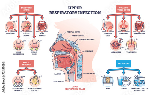 Upper respiratory infection with symptoms and types outline diagram. Labeled educational health condition scheme with coughing, sore throat and nasal problems vector illustration. Medical description