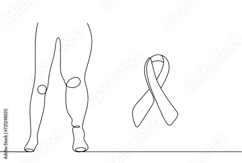 Lymphedema. Leg. Disease. Medicine. Ribbon