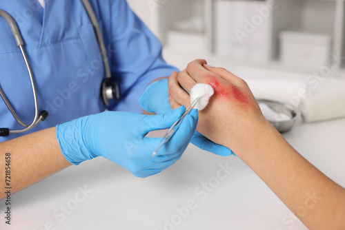 Doctor treating patient's burned hand at table, closeup