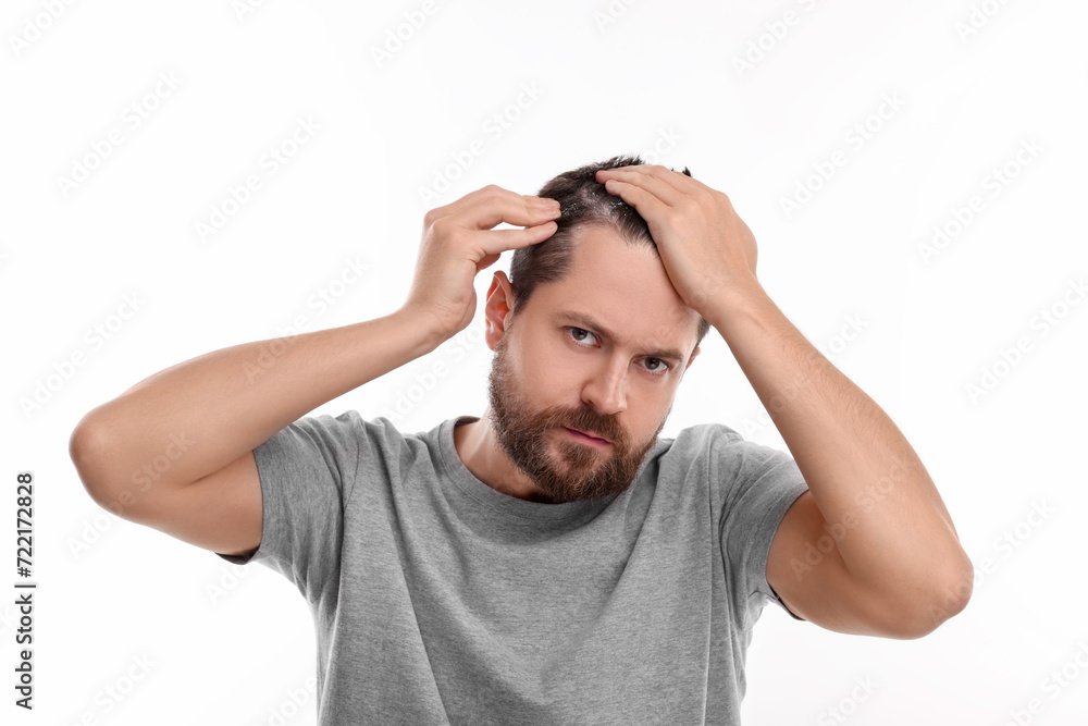 Man with dandruff in his dark hair on white background Man with dandruff in his dark hair on white background