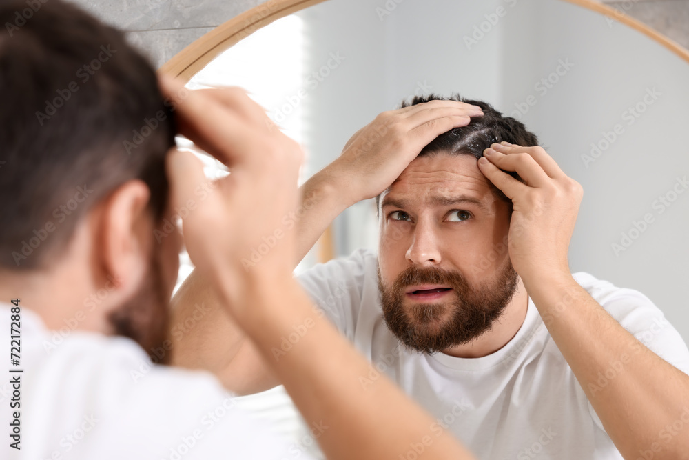 Man with dandruff in his dark hair near mirror indoors Man with dandruff in his dark hair near mirror indoors