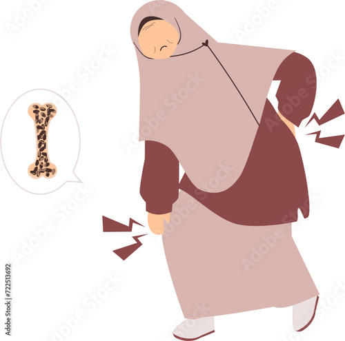 Osteoporosis Illustration 