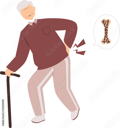 Osteoporosis Illustration 