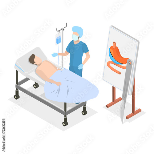 3D Isometric Flat Vector Illustration of Bariatric Surgery, Vertical Sleeve Gastrectomy. Item 1