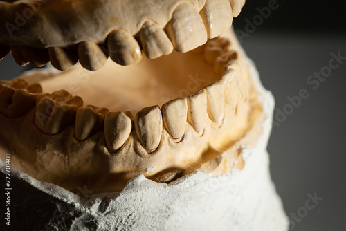 The image of a denture 