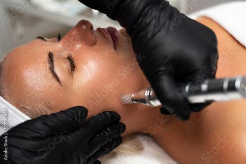 Microneedle RF lifting procedure. A cosmetologist performs a facial rejuvenation procedure on a woman. Hardware cosmetology.