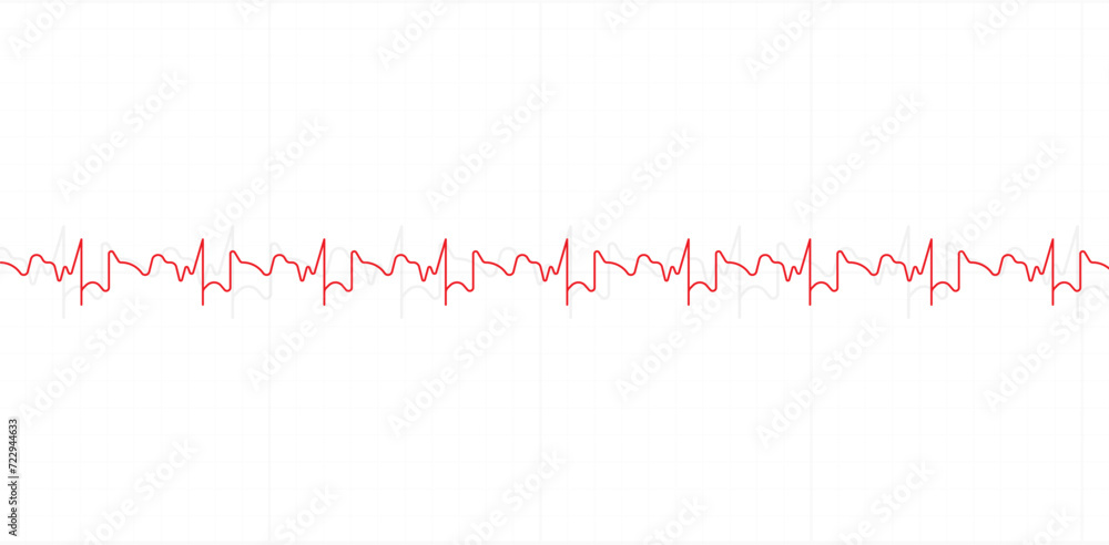 Naklejka premium Electrocardiography heartbeat line monitor. Ecg