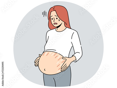 Tired pregnant woman with huge belly with stretch marks on last months of pregnancy. Exhausted unwell future mother awaiting childbirth. Vector illustration.