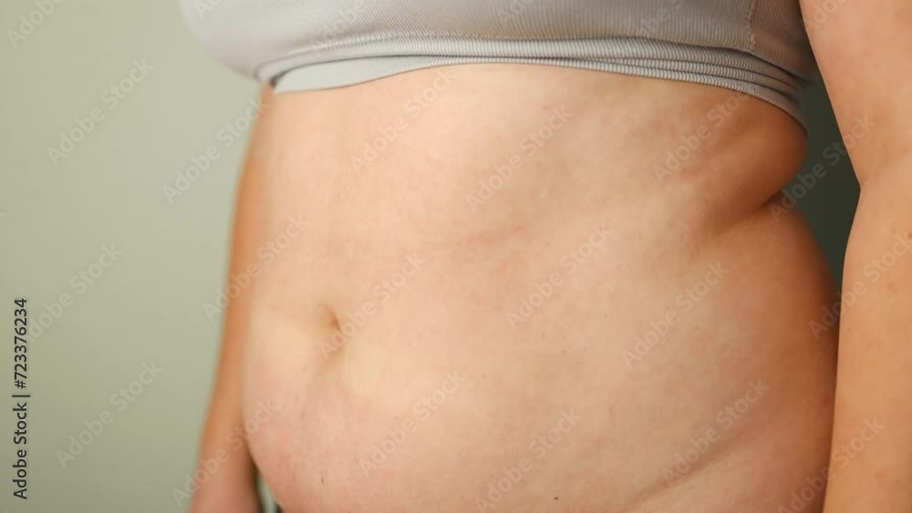Closeup of fat folds on big belly of overweight woman. Concept of excessive weight, obese female, dieting and overweight problems. High quality FullHD footage Closeup of fat folds on big belly of overweight woman. Concept of excessive weight, obese female, dieting and overweight problems. High quality FullHD footage