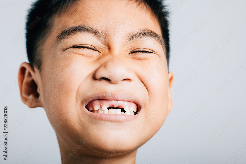 Smiling schoolboy tooth lost gap shows. Child isolated portrait on white. Joyful dental growth development. Children show teeth new gap, dentist problems. little boy no tooth Smiling schoolboy tooth lost gap shows. Child isolated portrait on white. Joyful dental growth development. Children show teeth new gap, dentist problems. little boy no tooth