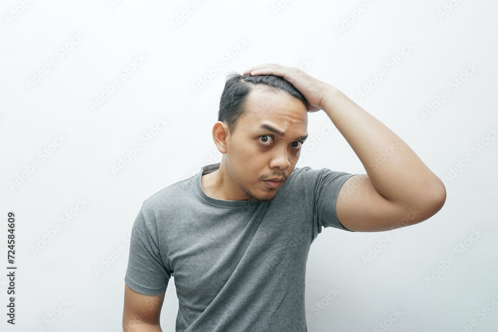 Asian man frustrated for getting bald and falling hair Asian man frustrated for getting bald and falling hair
