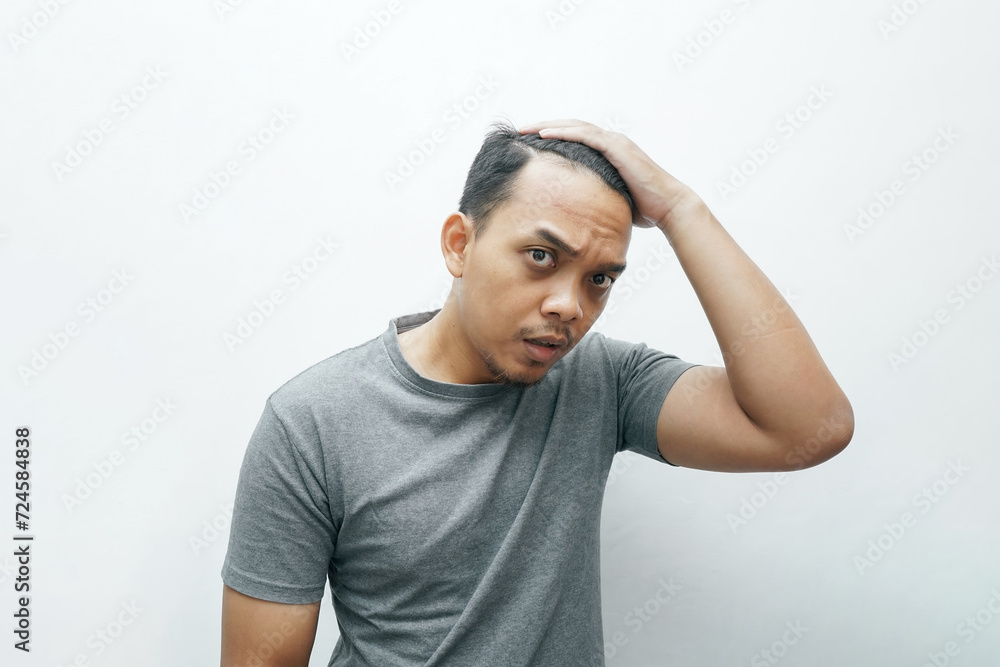 Asian man frustrated for getting bald and falling hair Asian man frustrated for getting bald and falling hair