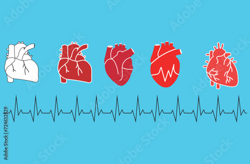 atrial fibrillation`,Medical illustration showing the symptoms of a heart with atrial fibrillation,Set human hearts,design concept of national atrial fibrillation awareness month observed,five set 