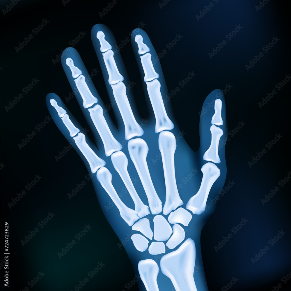 Naklejka premium Realistic 2D X-ray Hand Dark Medical Image