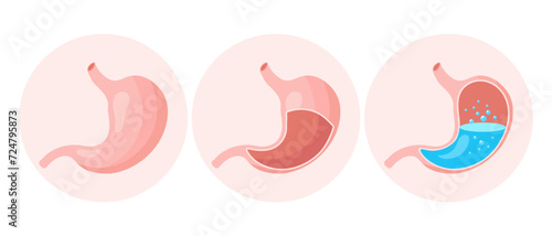 Healthy empty and full human stomach, medical icons set. Gastritis, ulcer, abdominal pain, bloating. Anatomy of the digestive system. Vector