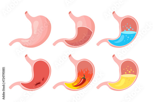 Healthy and unhealthy, empty and full human stomach in flat style, icons set. Nutrition, stomach pain, bloating. Anatomy of the digestive system. Vector