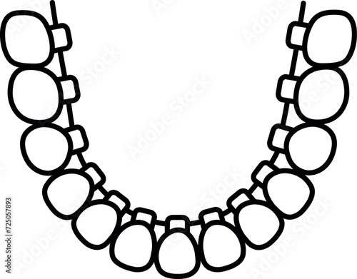 orthodontie linguale