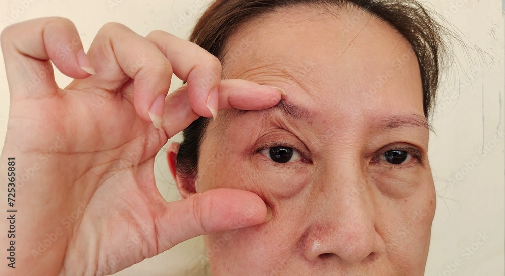 portrait showing the fingers holding the wrinkle and Flabby skin around the eyes, Flabbiness and loose beside the eyelid, dark spots and blemish on the face of the woman, health care and beauty.