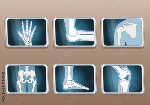 Knee, Elbow, wrist, hip, shoulder joints and Articulations of foot. Set icons.