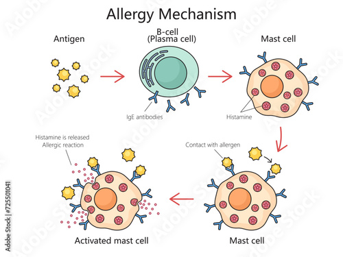 Mechanism of allergy action diagram hand drawn schematic vector illustration. Medical science educational illustration