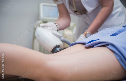 laser treatment for women on their legs