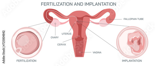 Ovulation, conception and implantation vector illustration. Anatomical diagram of fertilization and human reproductive process. Students learning and education study materials.